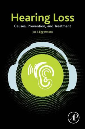 Cover of the book Hearing Loss by Srdjan M. Bulatovic