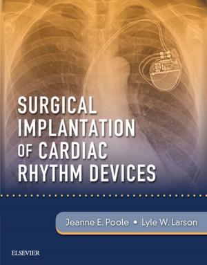 Cover of the book Surgical Implantation of Cardiac Rhythm Devices E-Book by David Paul Greene, PhD, MS, OTR, Susan L. Roberts, MDiv, OTR