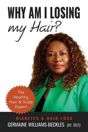 Book cover of Why Am I Losing My Hair? Diabetes & Hair Loss