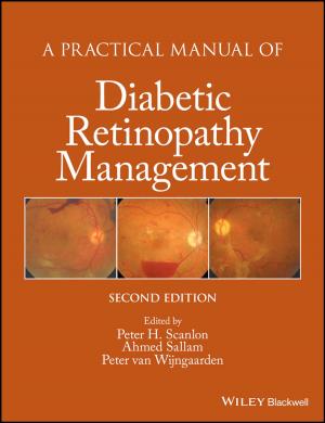 Cover of the book A Practical Manual of Diabetic Retinopathy Management by Pierre Massotte, Patrick Corsi