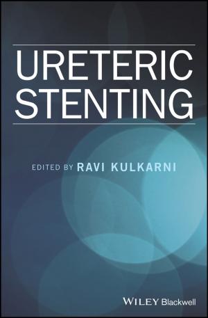 Cover of the book Ureteric Stenting by CCPS (Center for Chemical Process Safety)