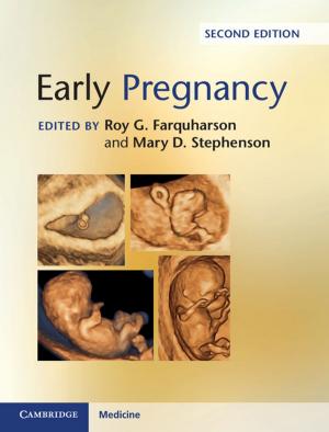 Cover of the book Early Pregnancy by Judith M. Lieu