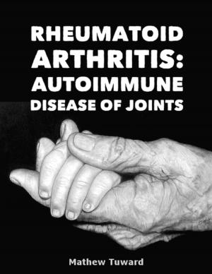 Cover of the book Rheumatoid Arthritis: Autoimmune Disease of Joints by Ken Silver
