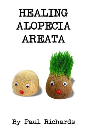 Cover of the book Healing Alopecia Areata by Zak Khan