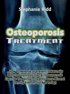 Cover of the book Osteoporosis Treatment: How to Reverse Or Prevent It Naturally With Osteoporosis Diet and Osteoporosis Exercise to Maintain Healthy Bone Mineral Density Even In Old Age Today! by Monica Davis