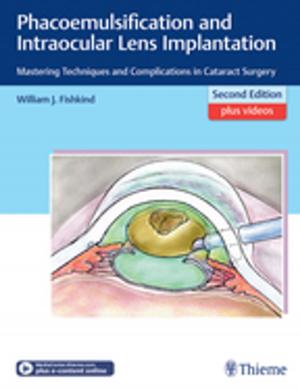Cover of the book Phacoemulsification and Intraocular Lens Implantation by 