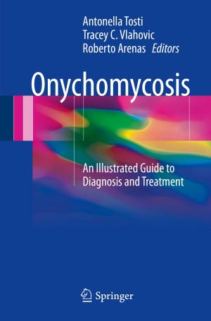 Cover of the book Onychomycosis by Timothy Johnson