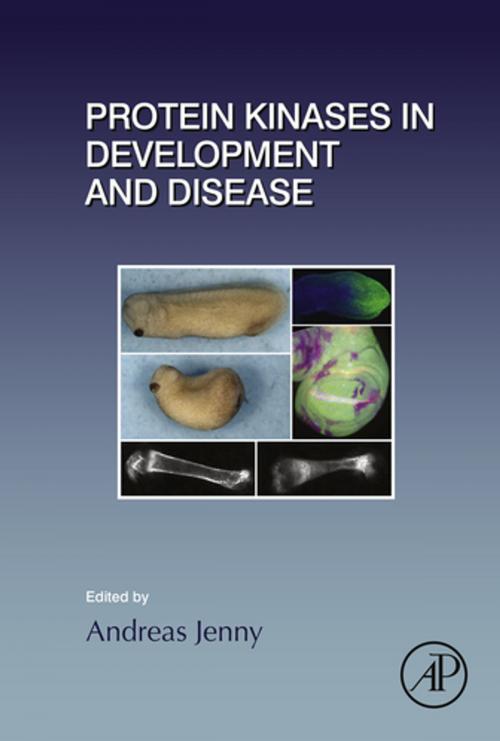 Cover of the book Protein Kinases in Development and Disease by Andreas Jenny, Elsevier Science