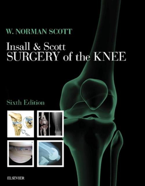 Cover of the book Insall & Scott Surgery of the Knee E-Book by W. Norman Scott, MD, FACS, Elsevier Health Sciences