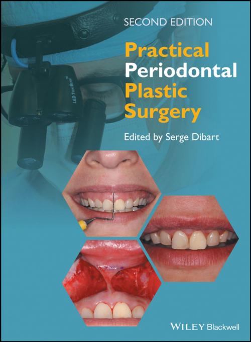 Cover of the book Practical Periodontal Plastic Surgery by , Wiley