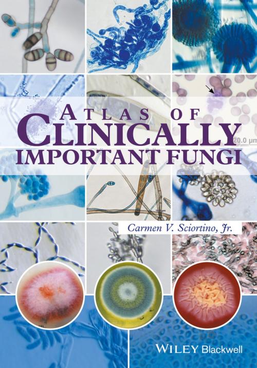 Cover of the book Atlas of Clinically Important Fungi by Carmen V. Sciortino Jr., Wiley