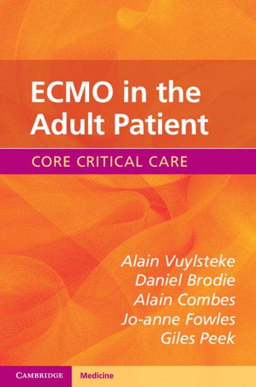 Cover of the book ECMO in the Adult Patient by Alain Vuylsteke, Daniel Brodie, Alain Combes, Jo-anne Fowles, Giles Peek, Cambridge University Press