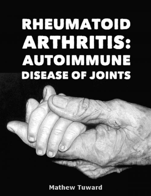 Cover of the book Rheumatoid Arthritis: Autoimmune Disease of Joints by Mathew Tuward, Lulu.com