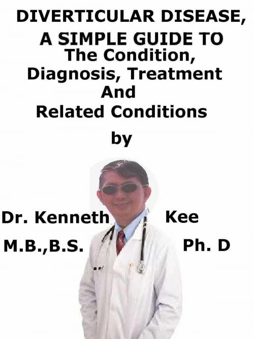 Cover of the book Diverticular Disease, A Simple Guide To The Condition, Diagnosis, Treatment And Related Conditions by Kenneth Kee, Kenneth Kee