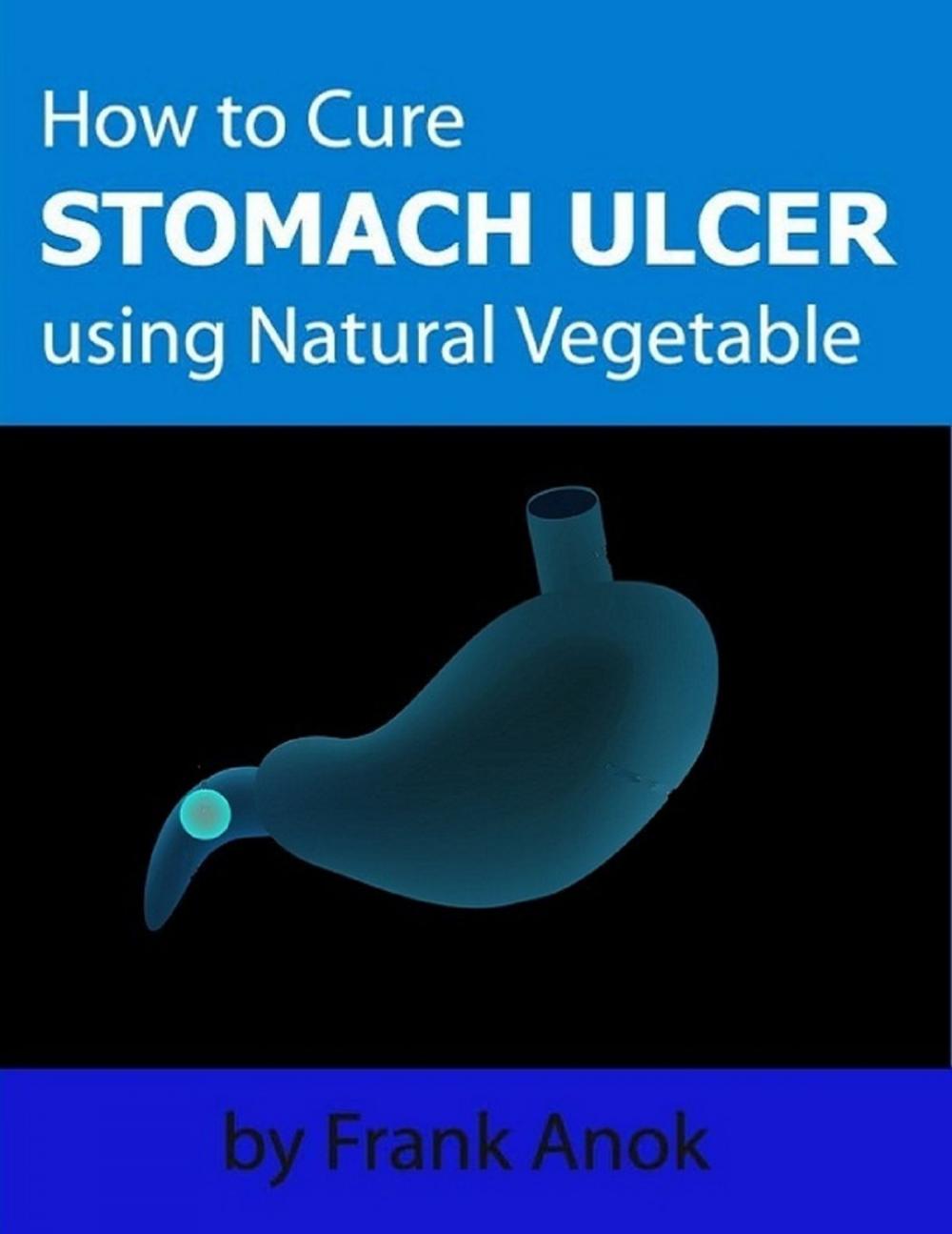 Big bigCover of How to Cure Stomach Ulcer Using Natural Vegetable
