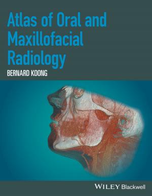 bigCover of the book Atlas of Oral and Maxillofacial Radiology by 
