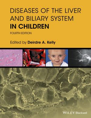 Cover of the book Diseases of the Liver and Biliary System in Children by James A. Momoh