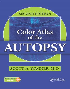 Cover of the book Color Atlas of the Autopsy by George Bruns, Michael Gunter