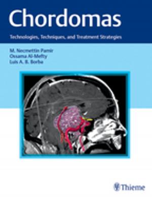 bigCover of the book Chordomas by 
