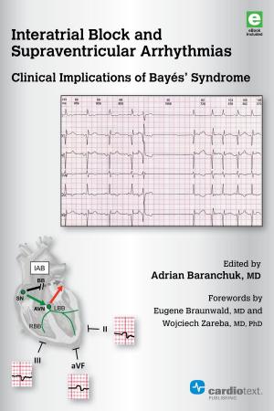 Cover of the book Interatrial Block and Supraventricular Arrhythmias: Clinical Implications of Bayés’ Syndrome by 