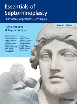 Cover of the book Essentials of Septorhinoplasty by Edward I. Bluth, Carol B. Benson, Philip W. Ralls