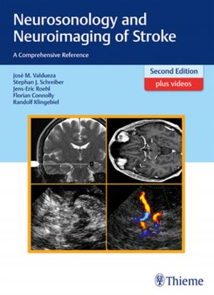 Cover of the book Neurosonology and Neuroimaging of Stroke by Sankhavaram R. Panini