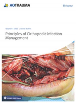 Cover of the book Principles of Orthopedic Infection Management by Fritz Barton