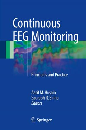 Cover of the book Continuous EEG Monitoring by Julieta Vartabedian