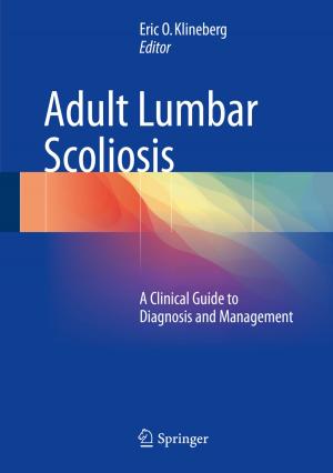 Cover of the book Adult Lumbar Scoliosis by Bart Vermeulen, Kees Goossens