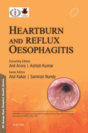 Cover of the book Sir Ganga Ram Hospital Health Series: Heartburn and Reflux Oesophagitis - e-book by Irl B. Hirsch, MD