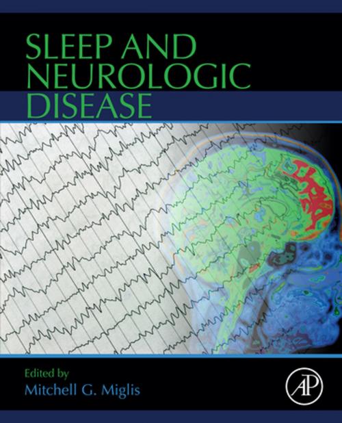 Cover of the book Sleep and Neurologic Disease by , Elsevier Science