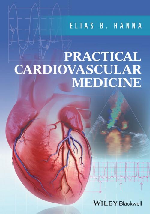 Cover of the book Practical Cardiovascular Medicine by Elias B. Hanna, Wiley
