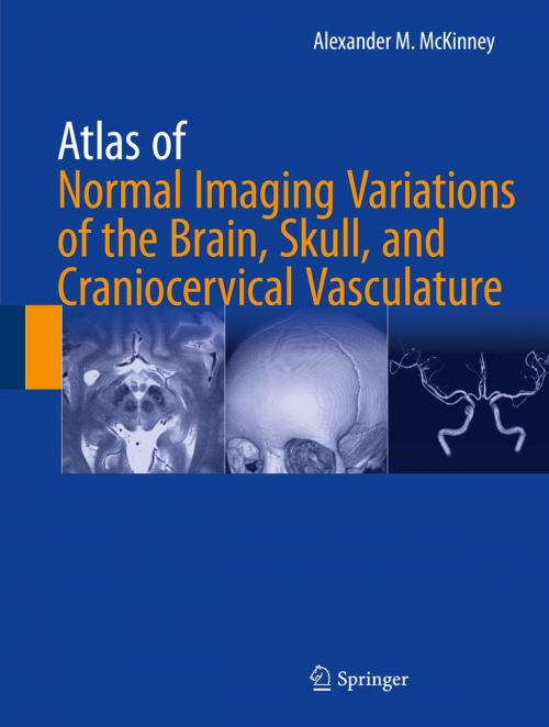 Cover of the book Atlas of Normal Imaging Variations of the Brain, Skull, and Craniocervical Vasculature by Alexander M. McKinney, Springer International Publishing