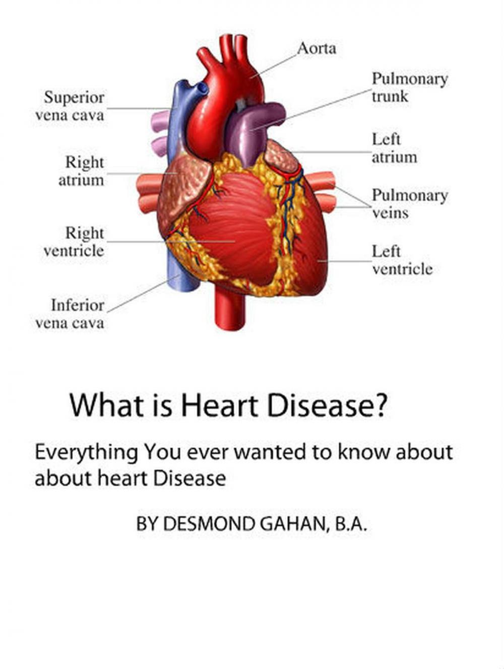 Big bigCover of What is Heart Disease? Everything you need to know about heart disease