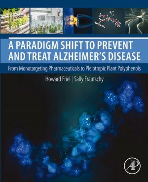 Cover of the book A Paradigm Shift to Prevent and Treat Alzheimer's Disease by Brien Posey