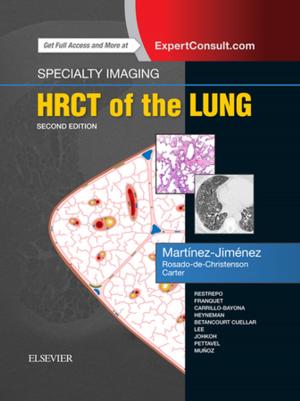 Book cover of Specialty Imaging: HRCT of the Lung E-Book