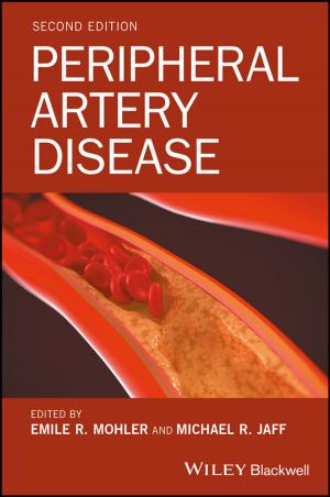 Cover of the book Peripheral Artery Disease by Jingyang Wang, Soshu Kirihara
