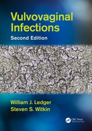Cover of the book Vulvovaginal Infections by Khursheed N. Jeejeebhoy
