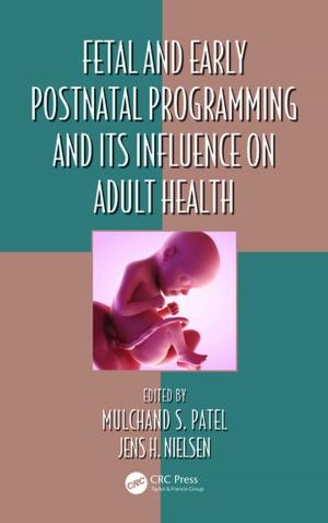 Cover of the book Fetal and Early Postnatal Programming and its Influence on Adult Health by Rajashekara Maiya, Balaji Raghunathan