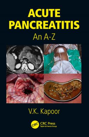 Cover of the book Acute Pancreatitis by Douglas Scarrett, Sylvia Osborn