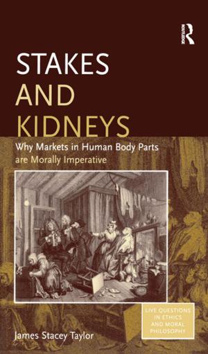 Cover of the book Stakes and Kidneys by Donald B. Corner, Jan C. Fillinger, Alison G. Kwok