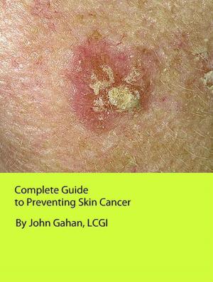 Book cover of Complete Guide to Preventing Skin Cancer