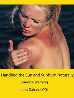 Book cover of Handling the Sun and Sunburn Naturally: Skincare Warning
