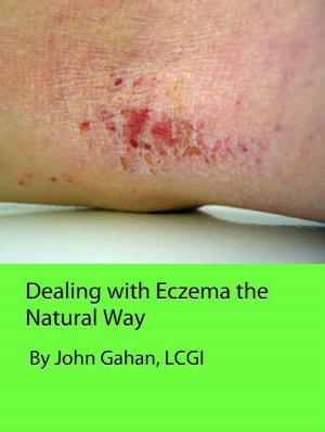 Book cover of Dealing with Eczema the Natural Way