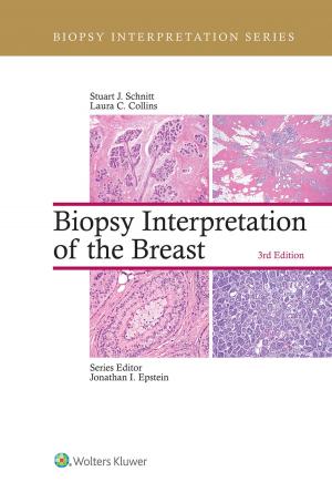 Cover of the book Biopsy Interpretation of the Breast by Jeff Unger