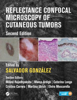 Cover of the book Reflectance Confocal Microscopy of Cutaneous Tumors by Mark C. Leake