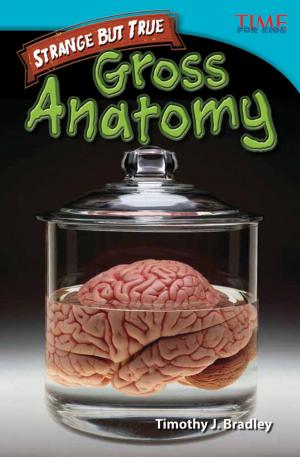 Book cover of Strange But True: Gross Anatomy