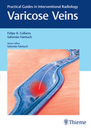 Cover of the book Varicose Veins by Livio Presutti, Daniele Marchioni