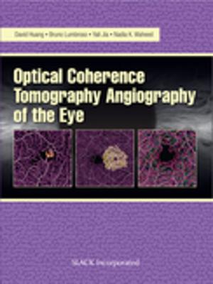 Cover of the book Optical Coherencre Tomography Angiography of the Eye by 