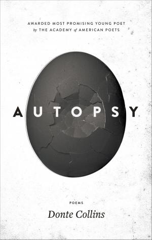 Cover of the book Autopsy by Dave Harris